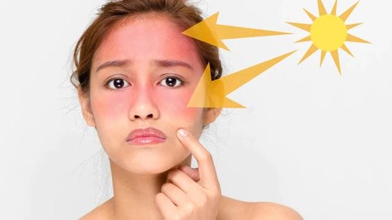 5 Lý Do Khiến Da Lão Hóa Có Thể Bạn Đang Mắc Phải lão hóa do nắng