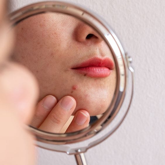 5 Lý Do Khiến Da Lão Hóa Có Thể Bạn Đang Mắc Phải chăm da không đúng cách