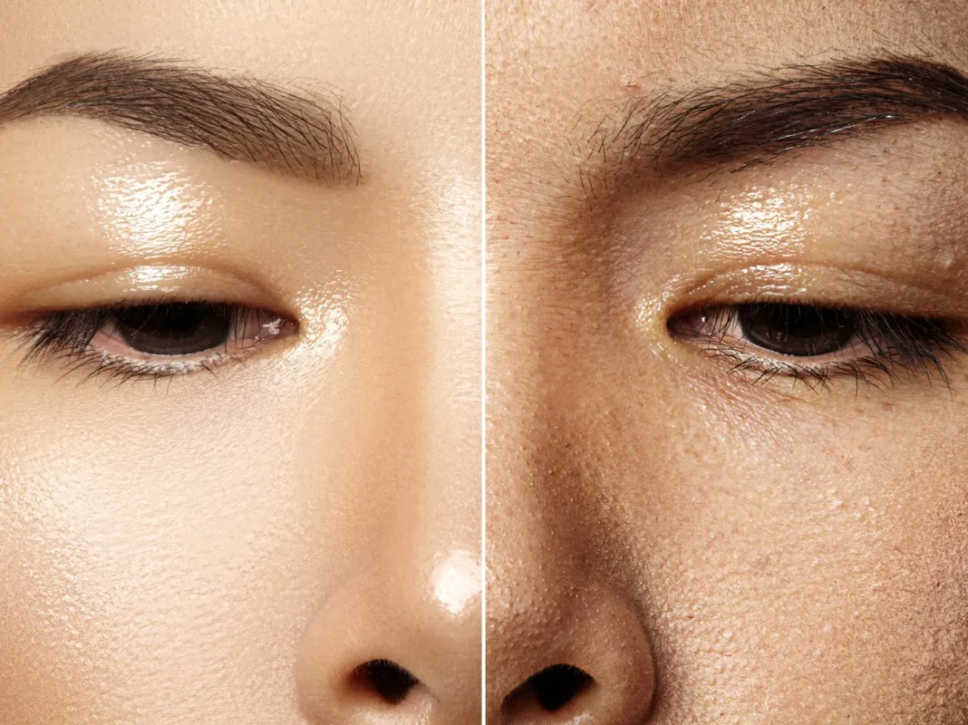 Mách Bạn 5 Bước Dưỡng Ẩm Trước Khi Make Up cakey cần dưỡng ẩm trước khi make up